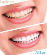 vickongdental