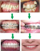 vickongdental